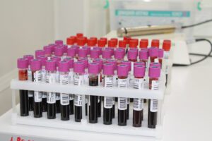 В Пензенской области фиксируют недостачу большинства групп крови